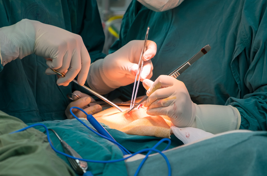 general surgery
