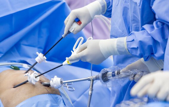 laprscopic and minimal access